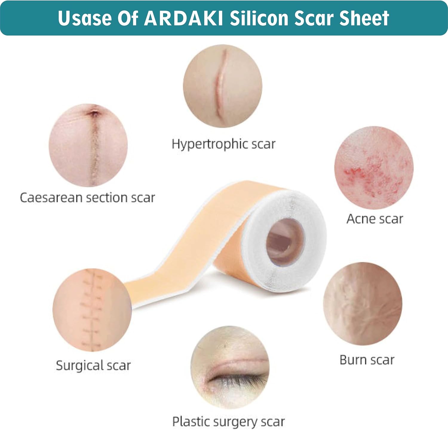 Silicone Scar Sheets,Silicone Scar Tape,Scar Tape for Surgical Scars,Silicone Scar Removal for Surgical,C-Section,Tummy Tuck,Keloid Scars, Face Tape, Keloid Bump Removal (1.6"X 60" Roll-1.5M) - Image 8