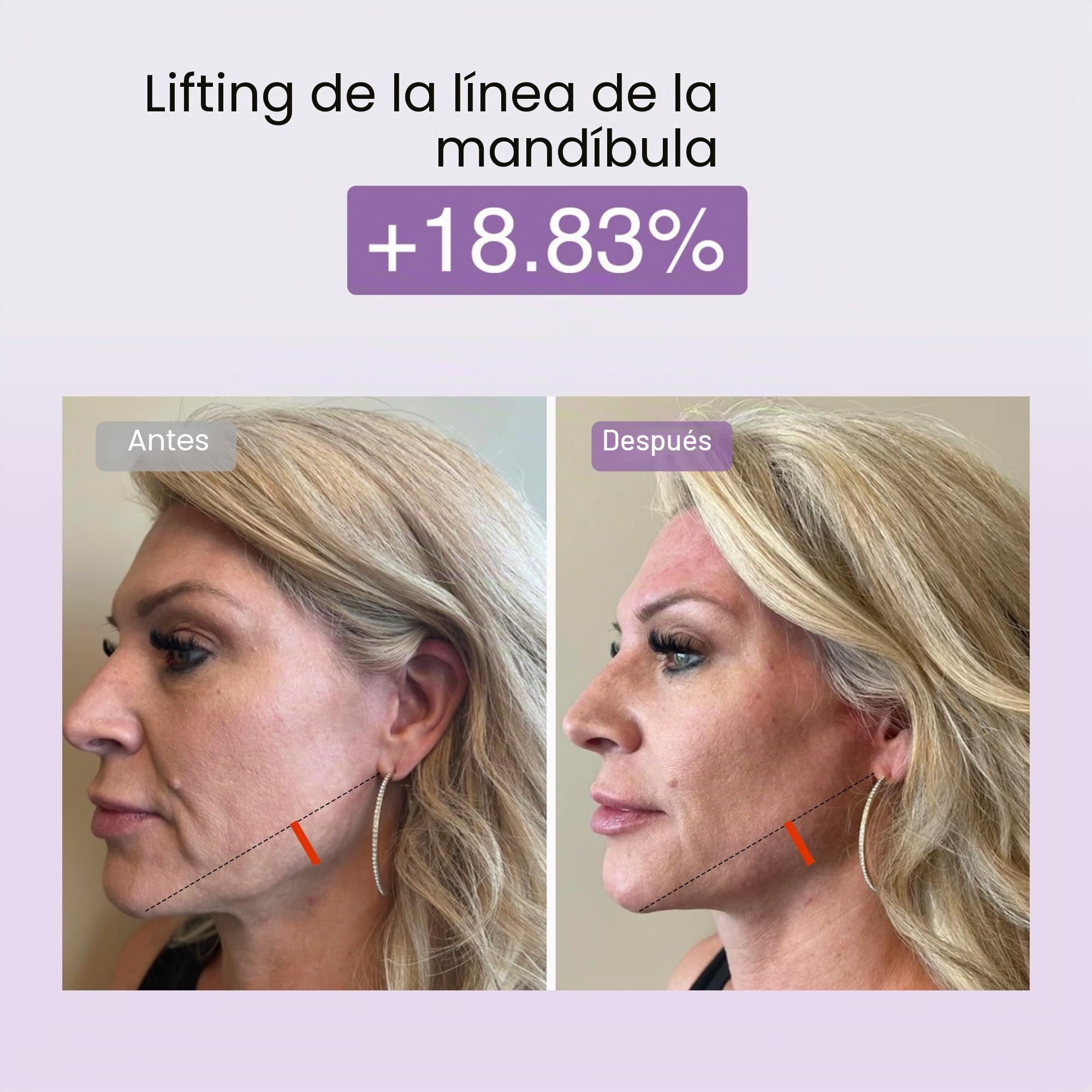 DermRays Dispositivo de belleza multifuncional M1,4 en 1, dispositivo facial de microcorriente para uso doméstico, dispositivo antienvejecimiento, para reafirmar la cara, arrugas, levantamiento