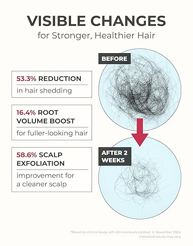 Miniatura 2 de Motifull Champú para engrosar el cabello con biotina y cafeína, champú para el crecimiento del cabello para raíces y volumen más fuertes (16.4 fl oz)