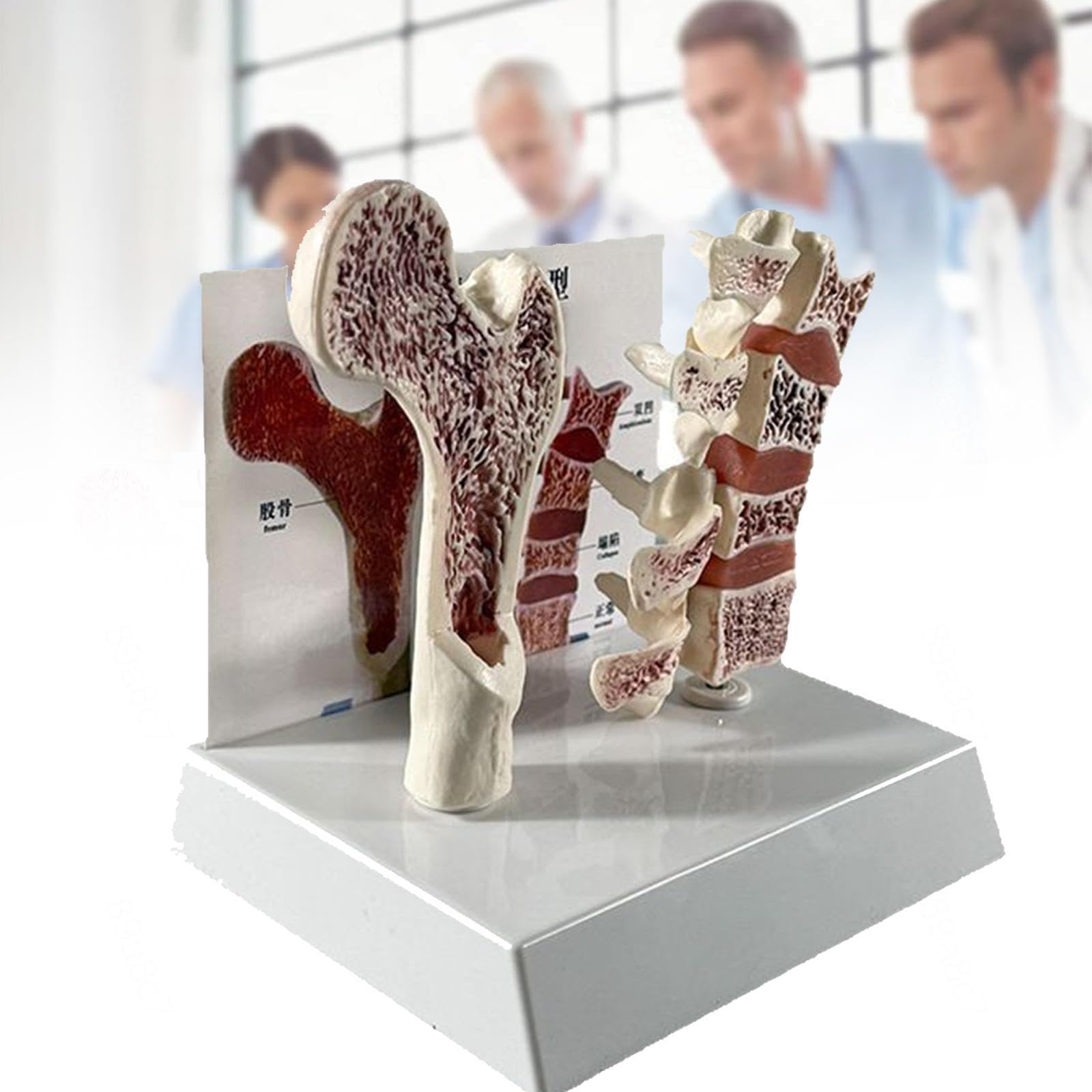 Bone Osteoporosis Model with Femur Cut and Degenerative Lumbar Spine, Educational Anatomical for Clinical Medical School