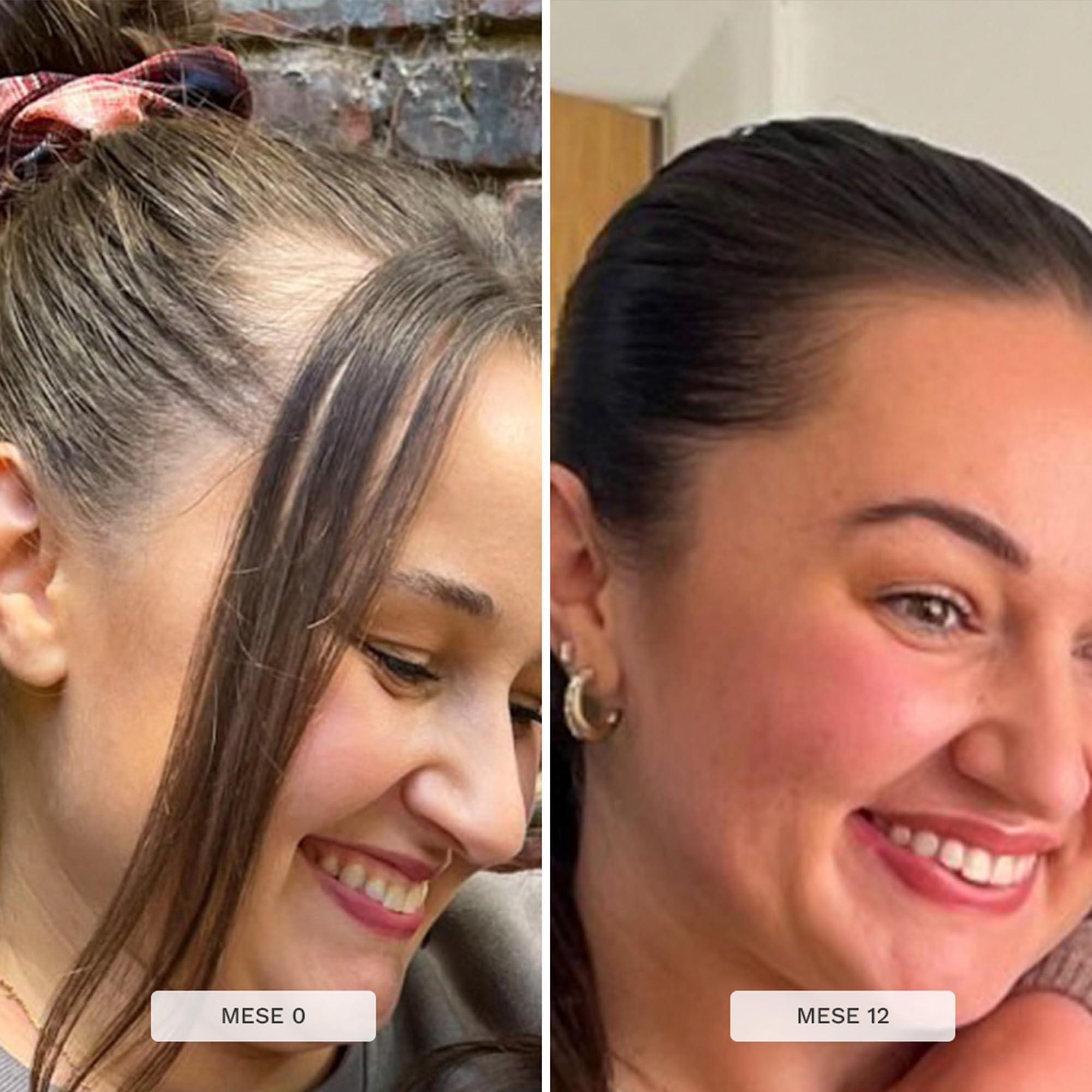 HAIR BURST Shampoo e Balsamo Set per la Crescita dei Capelli per le Donne Contro la Caduta e il Diradamento - Aumento della Crescita dei Capelli Sani