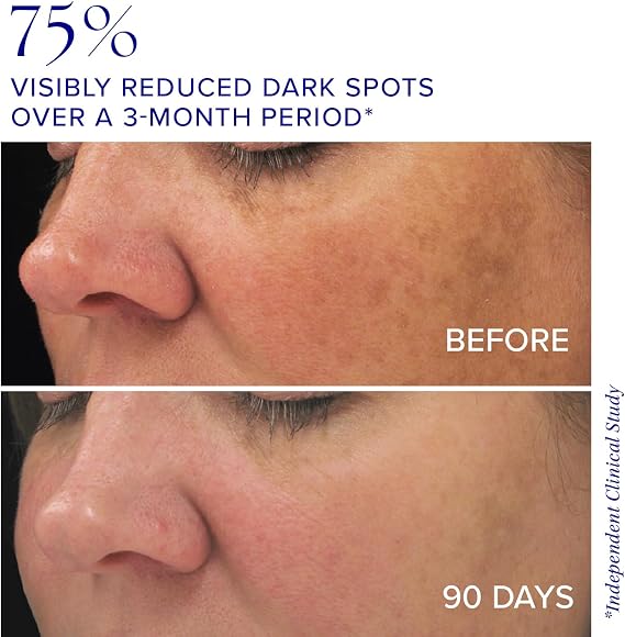 iS CLINICAL Brightening Complex - Skin Brightening Complex, Addresses Age Spots