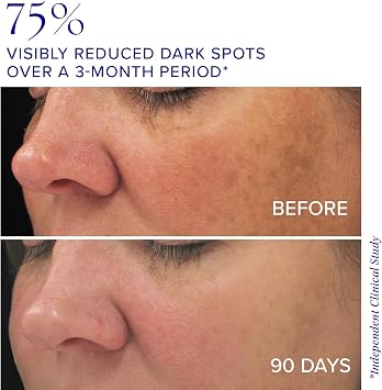 iS CLINICAL Brightening Complex - Skin Brightening Complex, Addresses Age Spots