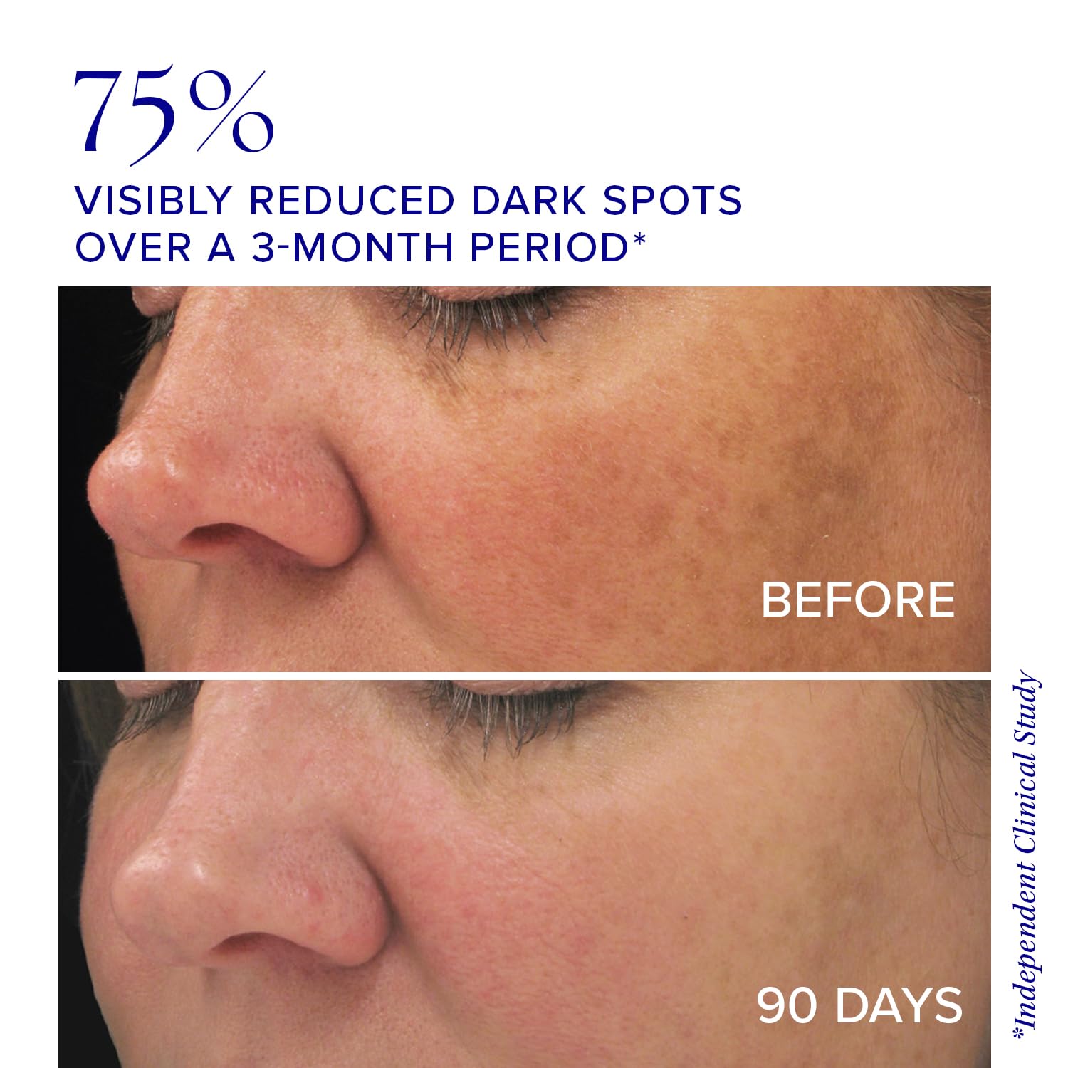 iS CLINICAL Brightening Complex, Skin Brightening Complex, Addresses Age Spots