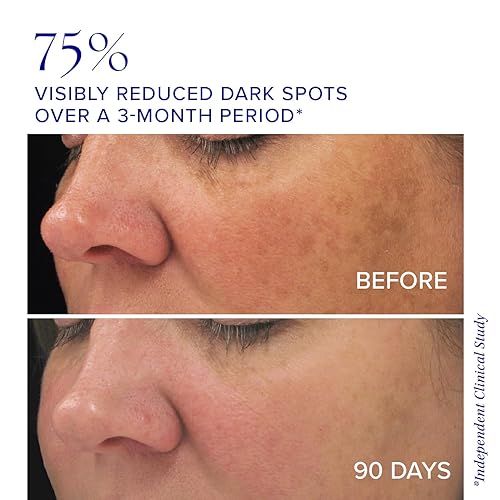 Miniatura 3 de iS CLINICAL Complejo iluminador de 1 onza