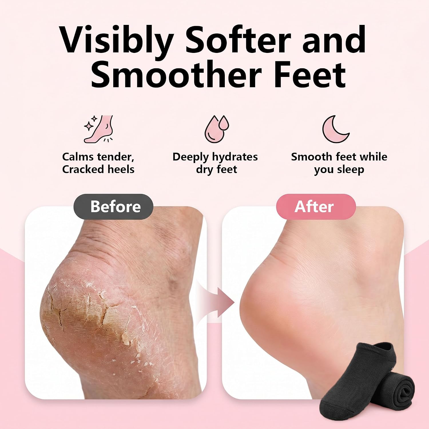 9.25 Inch FRYXT Black Silicone Moisturizing Socks for Women, 1 Pair Soft Foot Care Hydrating Socks, Reusable Moisturizing Socks for Dry Cracked Feet Rough Heels Skin Repair(Black)