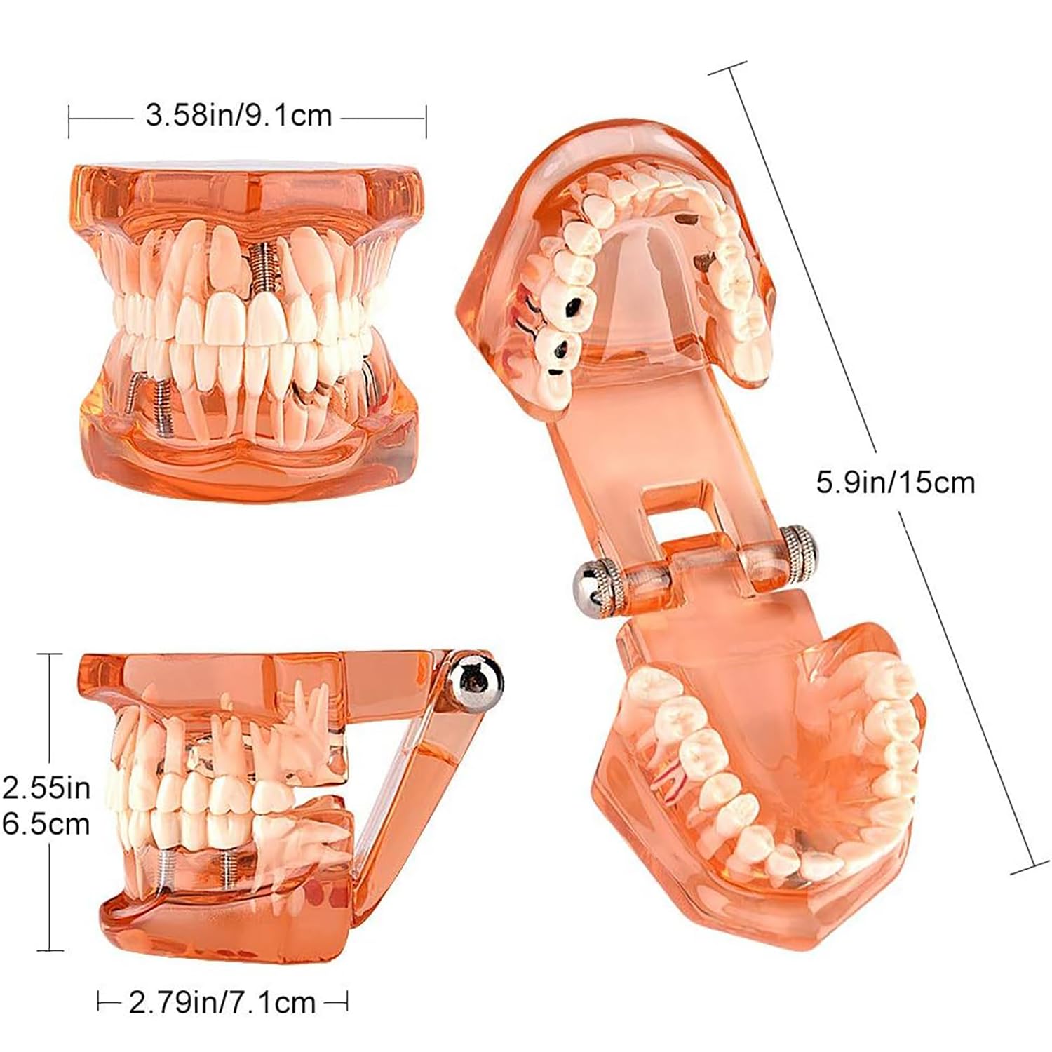 Pomarańczowy zdejmowany model zębów dentystycznych, model dentystyczny, nauczanie chorób zębów, model zębów implantologicznych, do komunikacji lekarz-pacjent