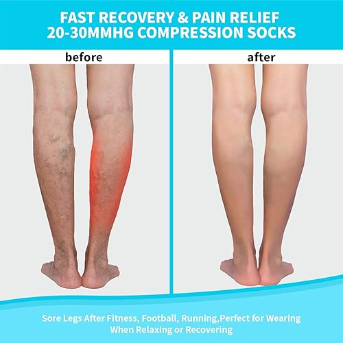 Miniatura 3 de Calcetines de compresión de punta abierta de 15-20 mmHg para mujeres y hombres, medias de compresión de circulación sin dedos hasta la rodilla