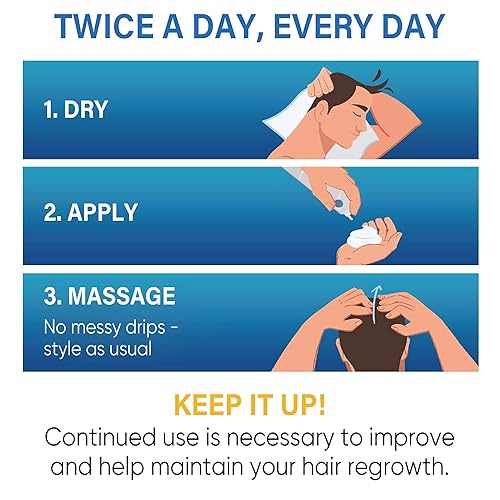 Miniatura 6 de Espuma de minoxidil al 5 % para el crecimiento del cabello de hombres y mujeres, espuma de minoxidil para hombres y mujeres, tratamiento de