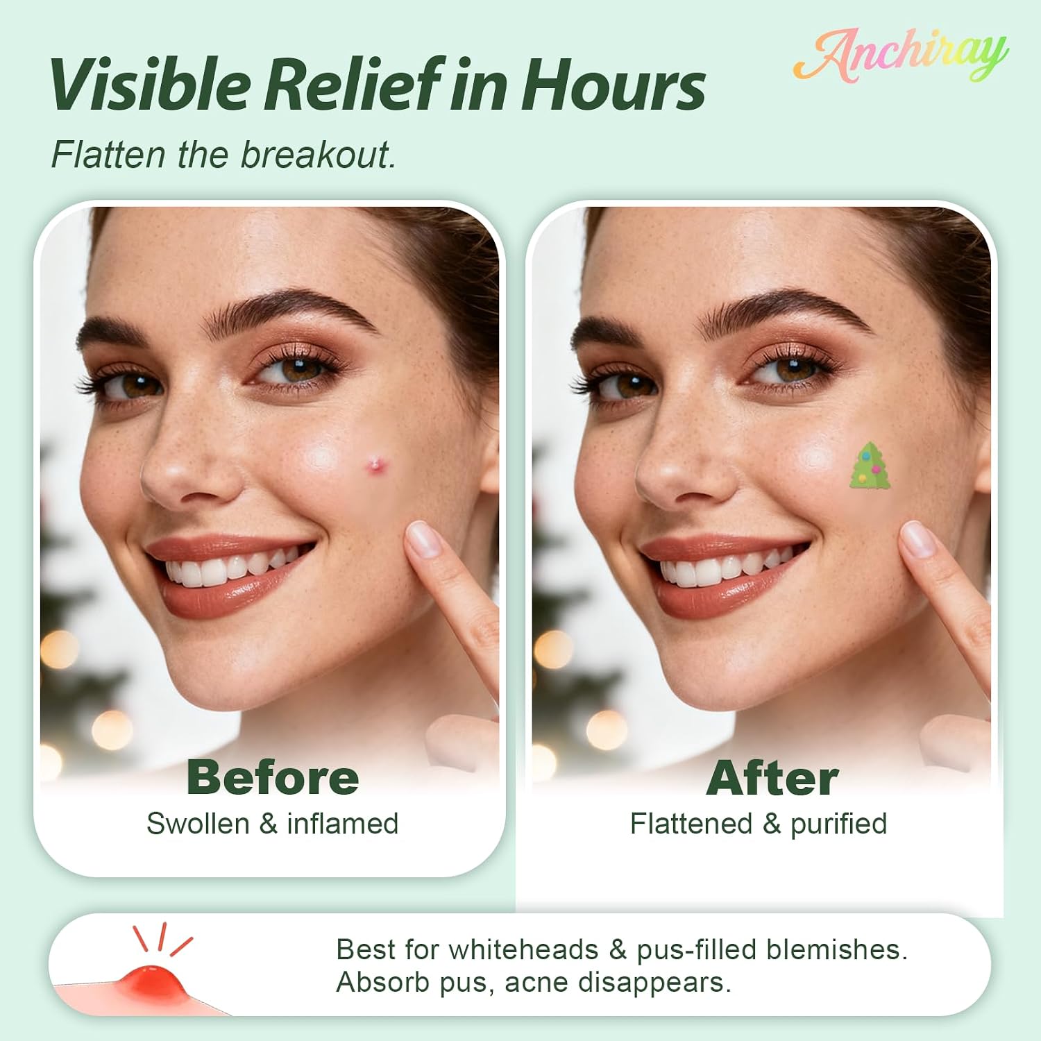 Festival Theme Acne Patches for Face, All Skin Types, 80 Counts image 5