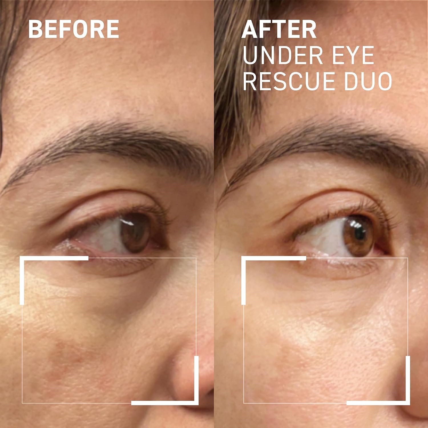 UNDER EYE RESCUE DUO, No More Baggage 0.5oz + id-Stress Fatigue Fighting Eye Gel, 0.5oz