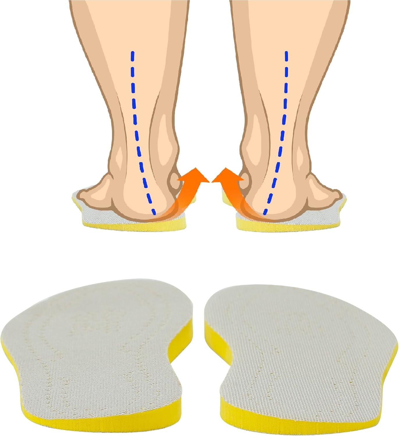 Amazon.com: Overpronation Insoles for Men and Women,Pronation Corrective Heel Shoe Inserts, Heel