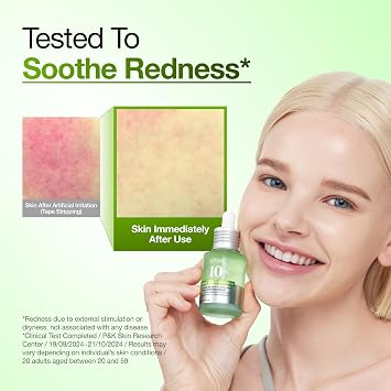 Anua Azelaic Acid 10 Hyaluron Redness Soothing Serum, Facial Serum for Blemish-Prone & Oily-Prone Skin, Lightweight & Hydrating Blemish Care, Hyaluronic Acid, Korean Skincare, 1.01 fl oz.