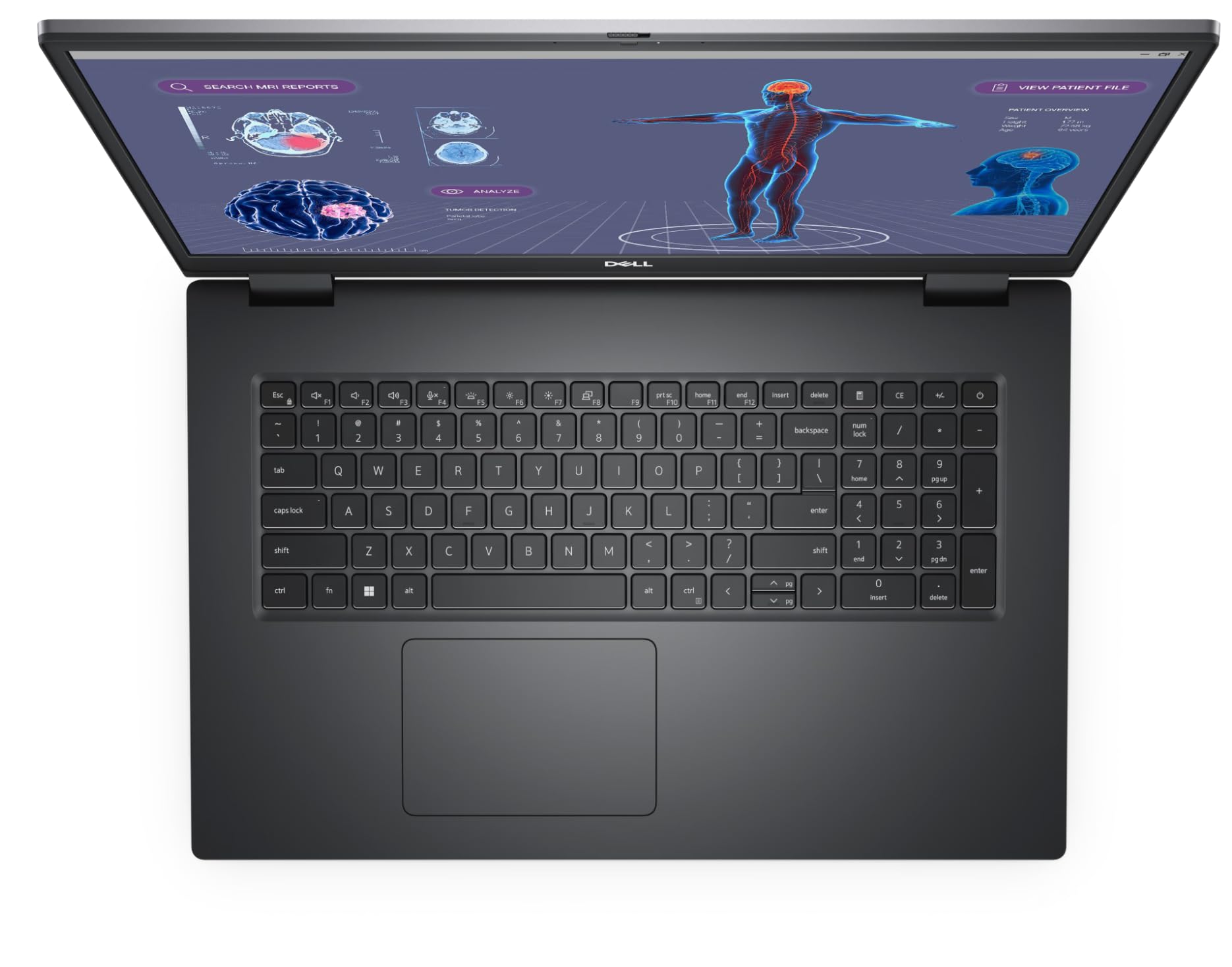 Amazon.com: Dell Precision 7780 17