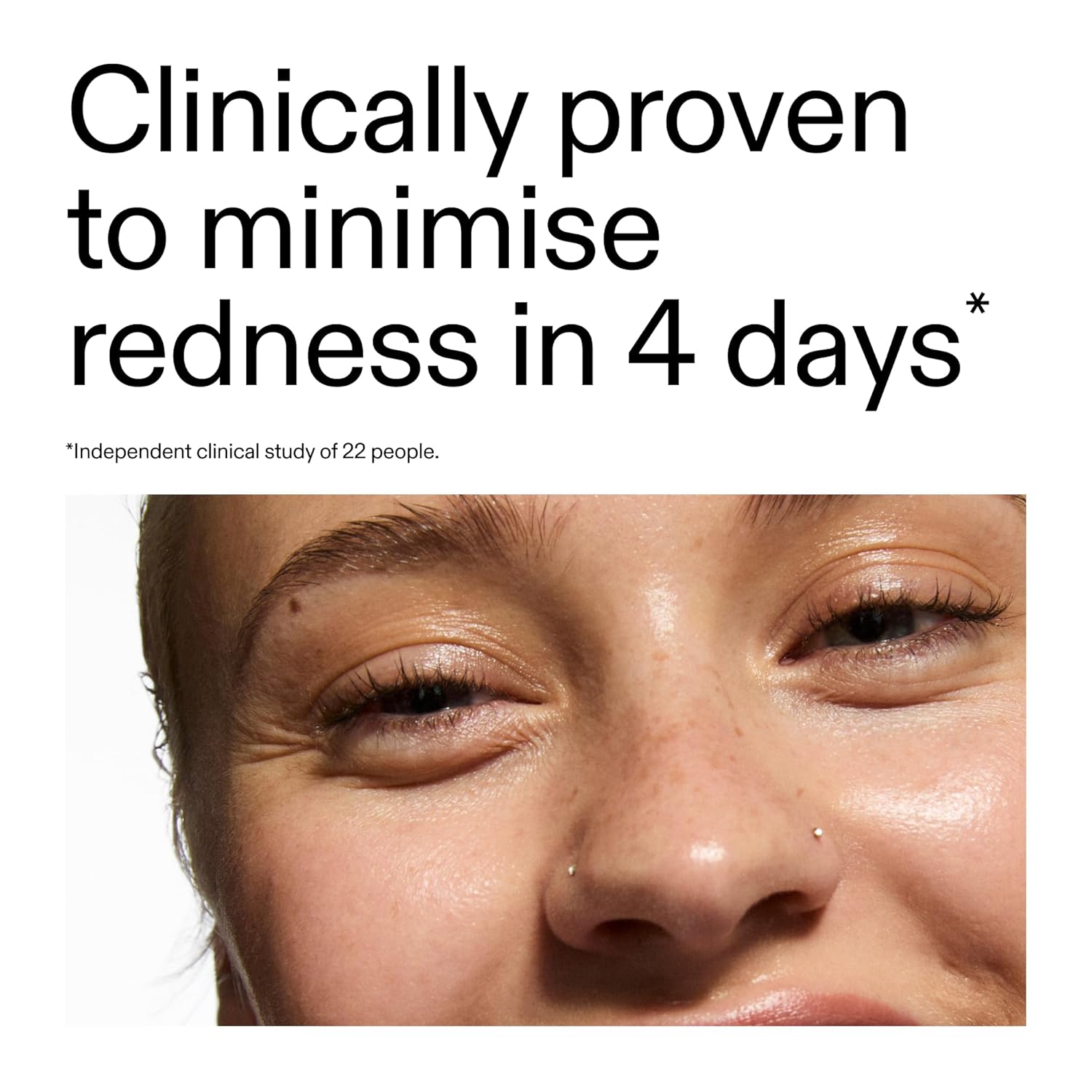 The INKEY List SuperSolutions Azelaic Acid 10% Serum, Fast-Absorbing Formula Helps Reduce Appearance of Redness and Soothes Skin, Leaves No White Cast, 1.01 fl oz - Image 3