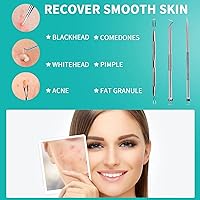 Vista 5 de WSYUB Herramienta para reventar espinillas, extractor de espinillas de acero inoxidable, pinzas WSYUB para puntos negros, kit de eliminación de acné