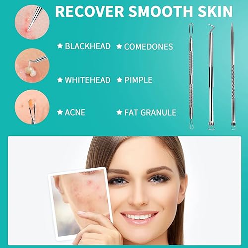 Miniatura 5 de WSYUB Herramienta para reventar espinillas, extractor de espinillas de acero inoxidable, pinzas WSYUB para puntos negros, kit de eliminación de acné