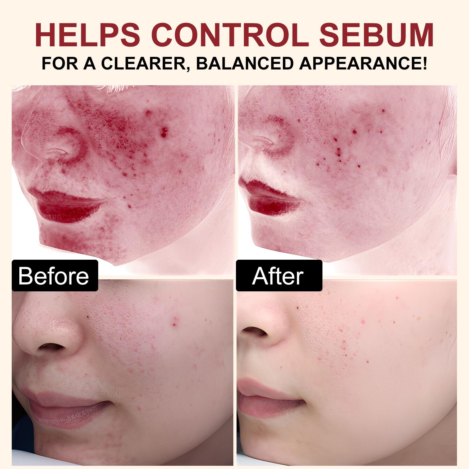 Siero Esfoliante al Riso 100ml, Siero Coreano Esfoliante al Riso, Peeling Viso Delicato,Scrub Viso Anti Punti Neri Rimozione, Riduce Pori, Idratante e Illuminante,Rimuove Cellule Morte,pelli sensibili