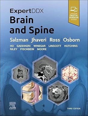 ExpertDDx: Brain and Spine - 3E