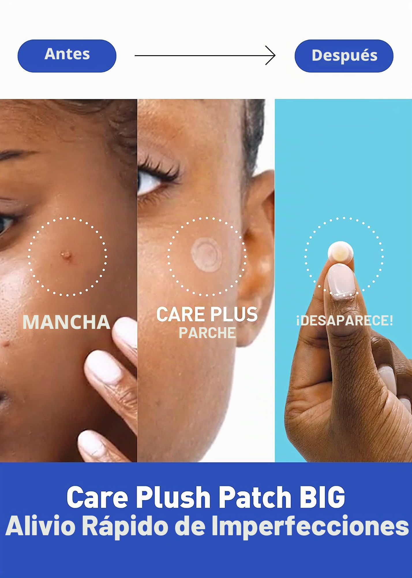OLIVE YOUNG Care Plus - Parche hidrocoloide para acné coreano para cubrir granos, espinillas e imperfecciones, para piel y cara con problemas (hidrocoloide, 102 unidades (paquete de 1))