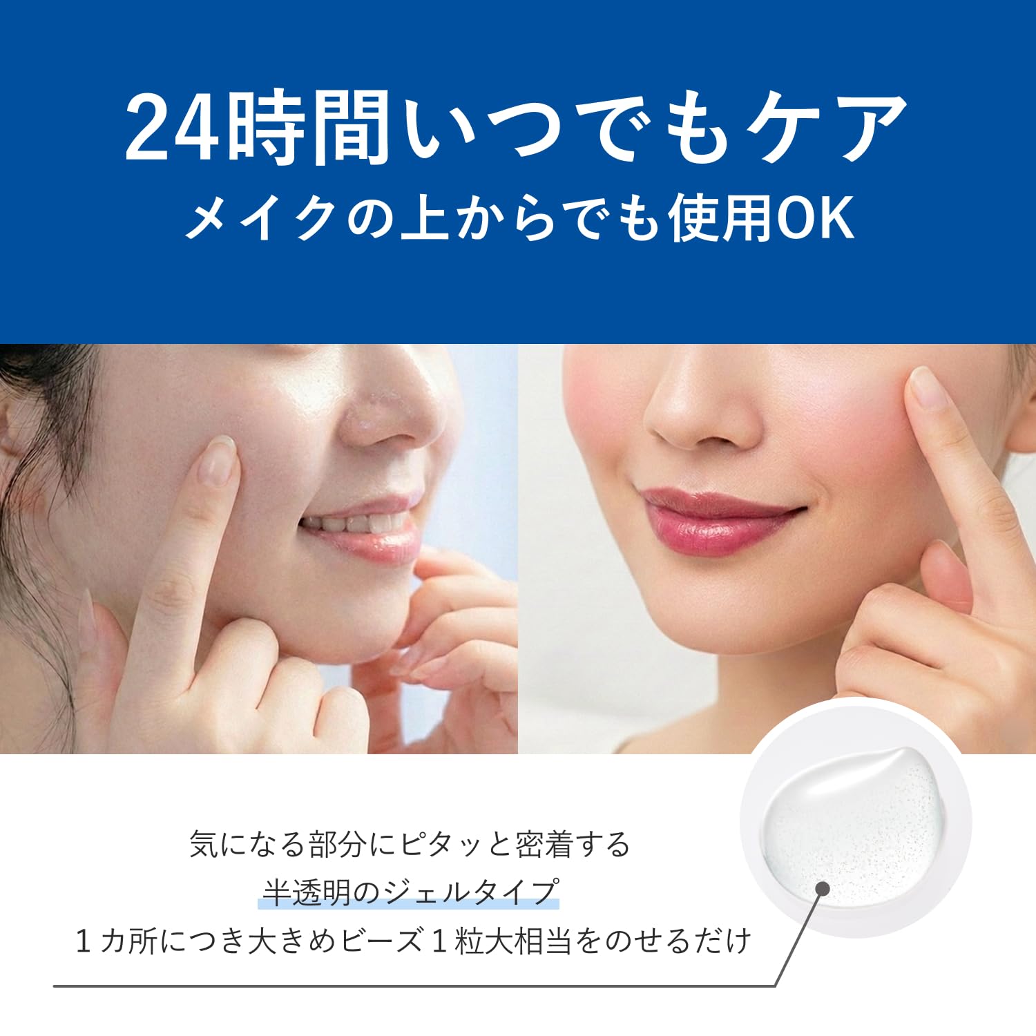 ORBIS(オルビス医薬部外品クリアフルアクネスポッツ薬用ニキビスキンケア20g Amazon | ORBIS(オルビス) 医薬部外品 クリアフルアクネスポッツ 薬用