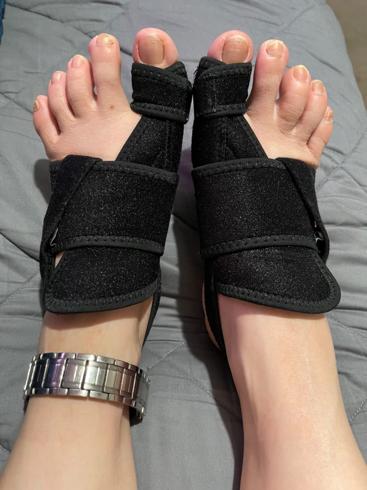 5/mo Finance Caretras Bunion Corrector for Women & Men 2pc