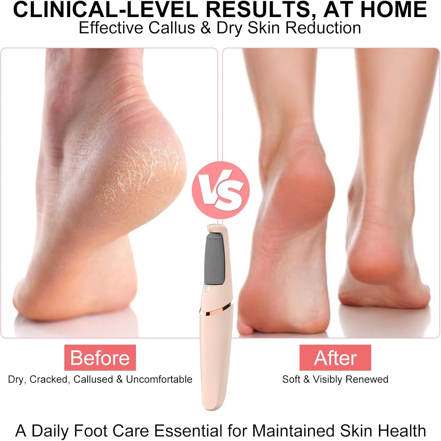 Electric Foot File, Callus Remover for Feet,Rechargeable Foot Pedicure Tool for Dry &Dead Cracked Skin,Professional Cordless Hard Skin Removal with 2 Durable Heads - Image 2