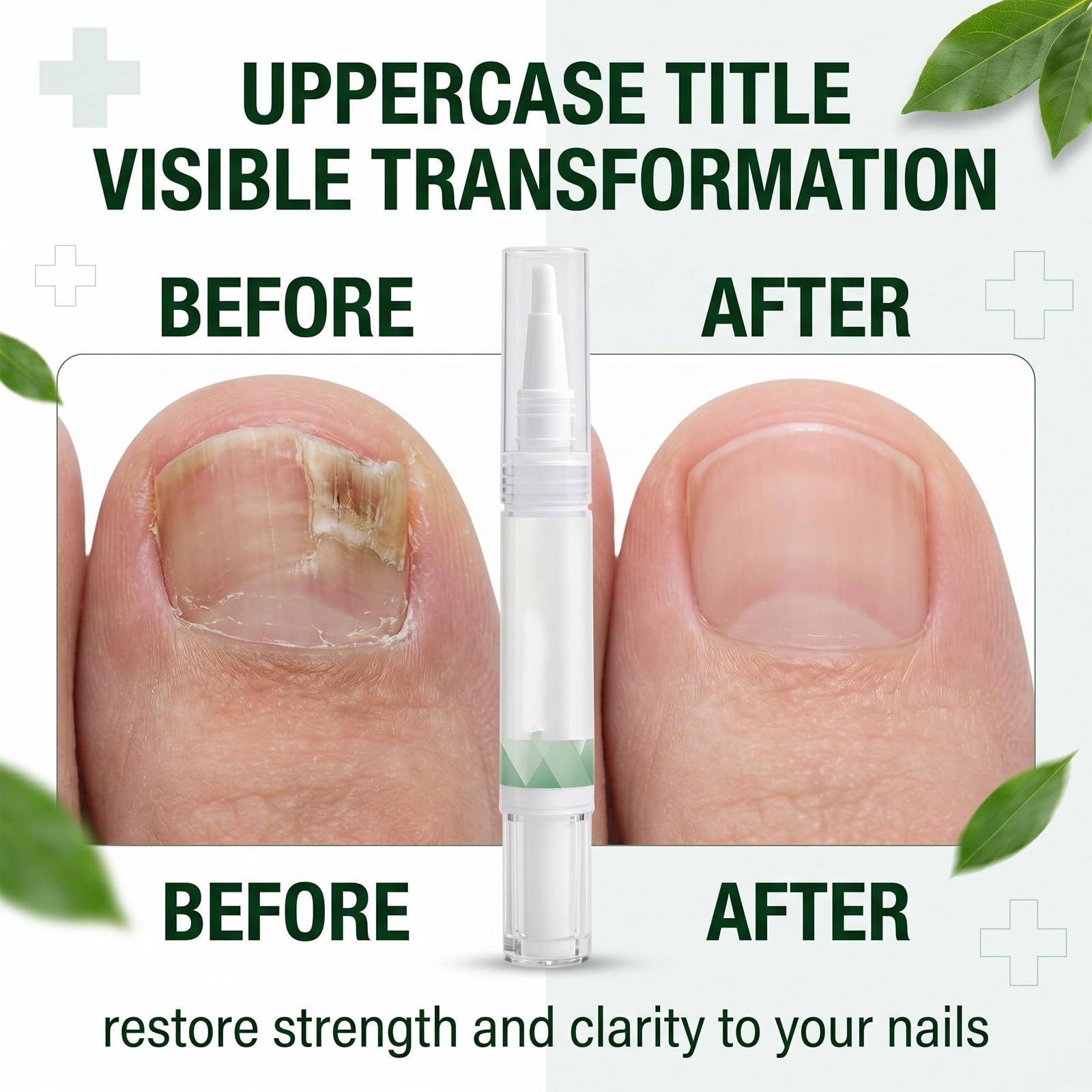 2 Pezzi Nail Care Pen per Micosi Unghie Piedi e Mani, Penna per Trattamento Unghie Danneggiate e Fragili, Soluzione per la Cura e Rigenerazione delle Unghie, 2 x 5g