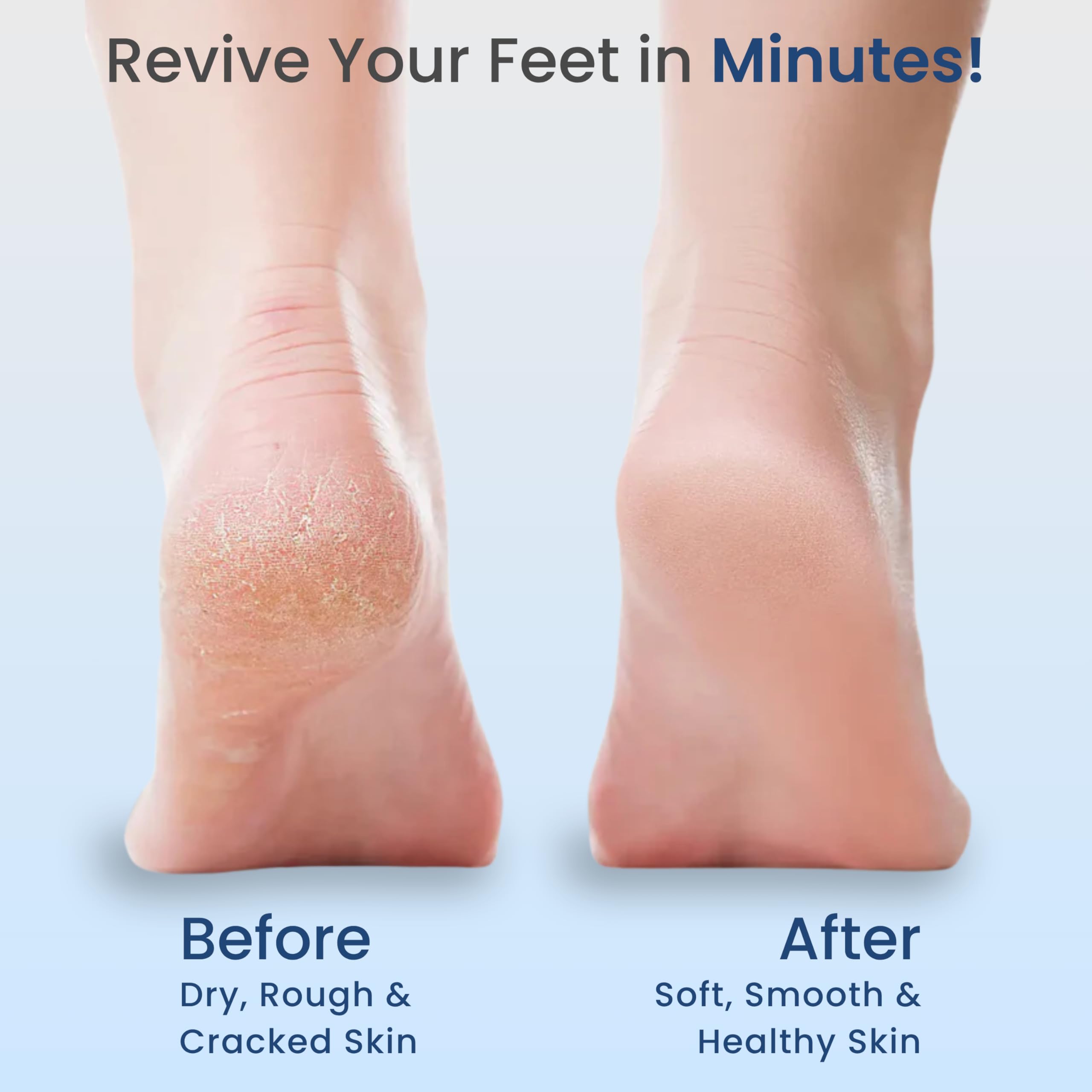 MEDTECH® Revive Rechargeable Callus Remover | Electric Foot Scrubber for Dead Skin Removal | 3 Crystal Quartz Heads for Dead Skin Removal | Pedicure Machine for Home | Pedicure Kit For Women - Image 3 thumbnail