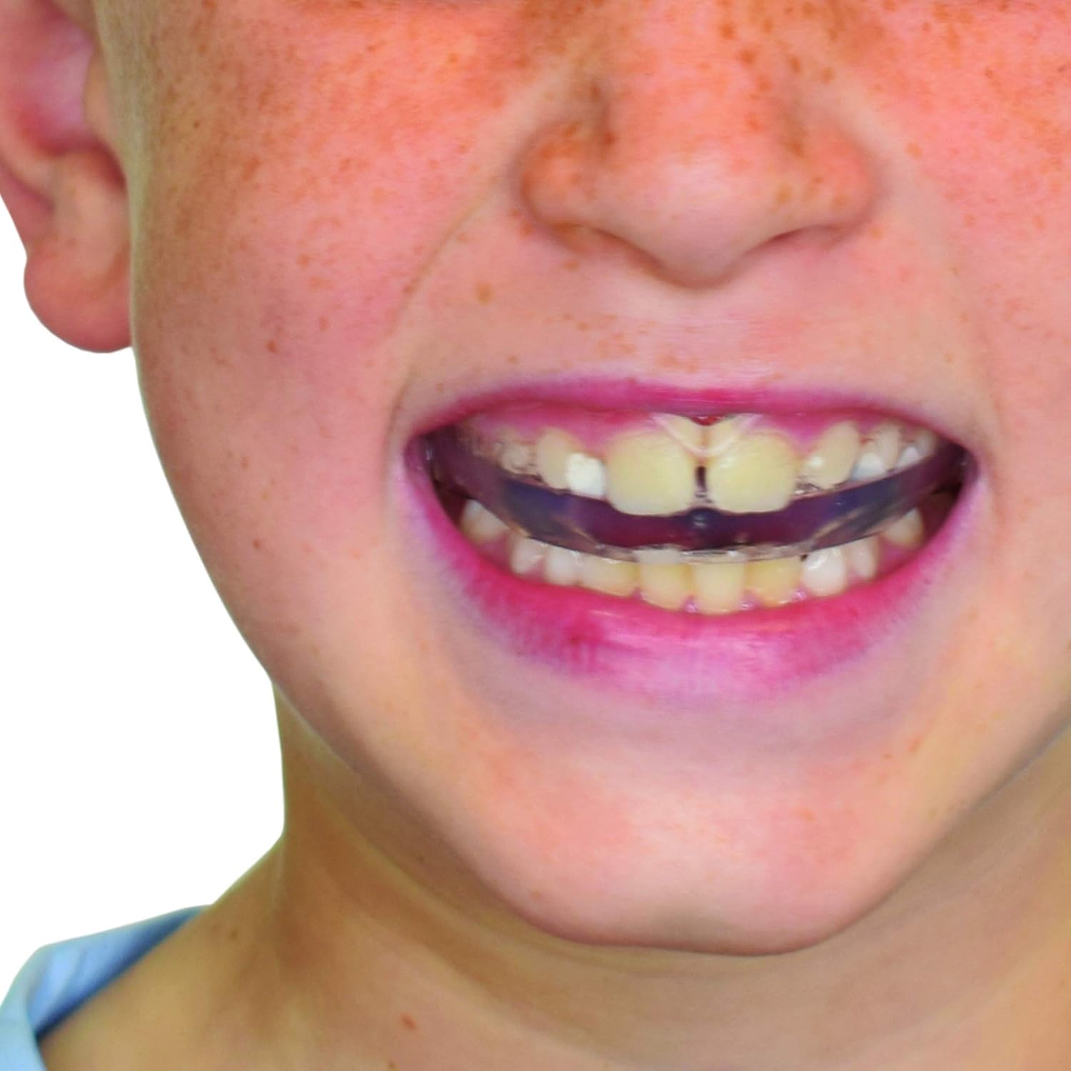 SAFEJAWZ Mouthguard Slim Fit, Adults and Junior Mouth Guard with Case for Boxing, Basketball, Lacrosse, Football, MMA, Martial Arts, Hockey and All Contact Sports : Sports & Outdoors
