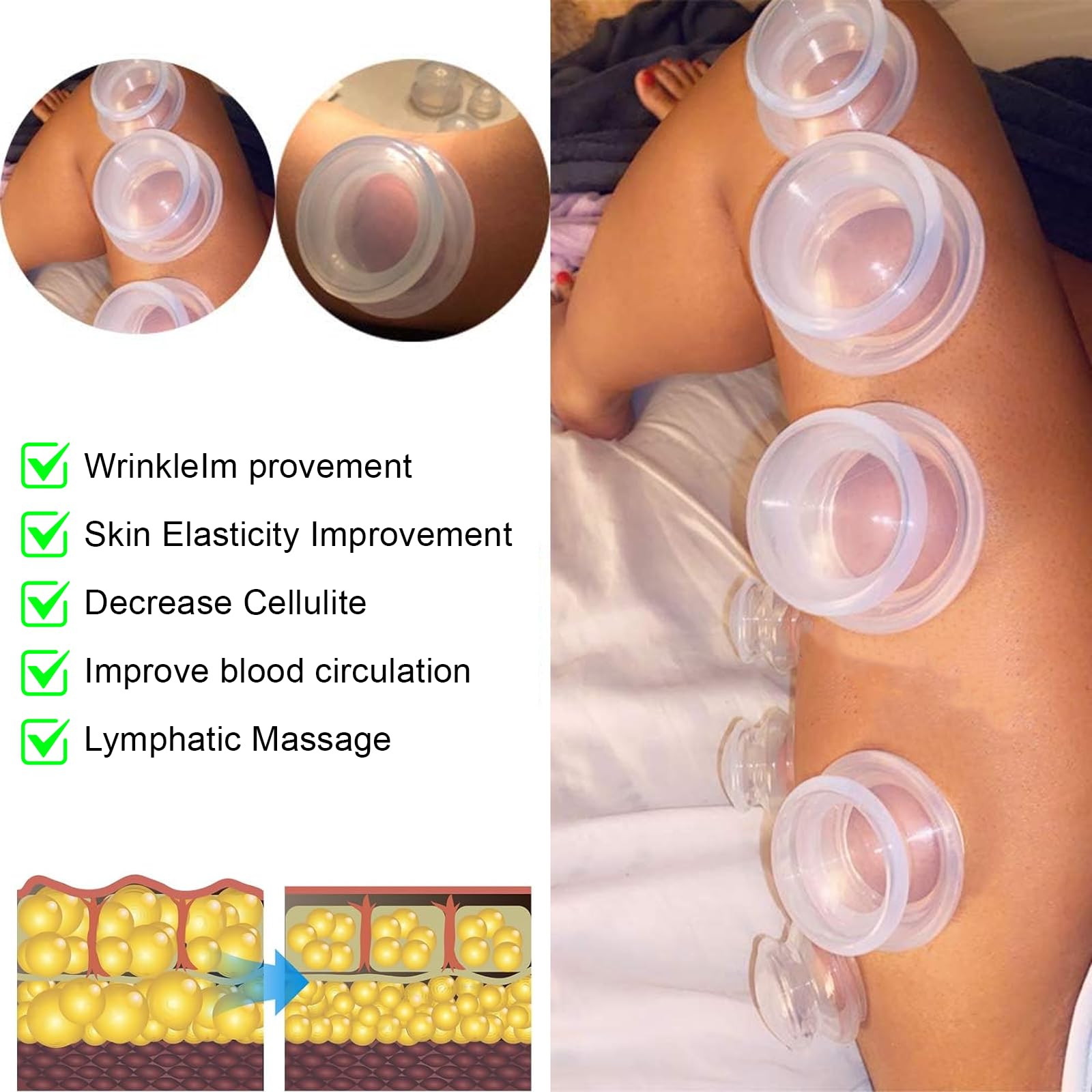 Kit de 7 Ventouse Massage Anti Cellulite,Ventouses en Silicone Thérapeutiques, pour Massage Kiné du Dos et du Corps, Améliore la Circulation, Aide à Raffermir la Peau, Compatible avec les Huil