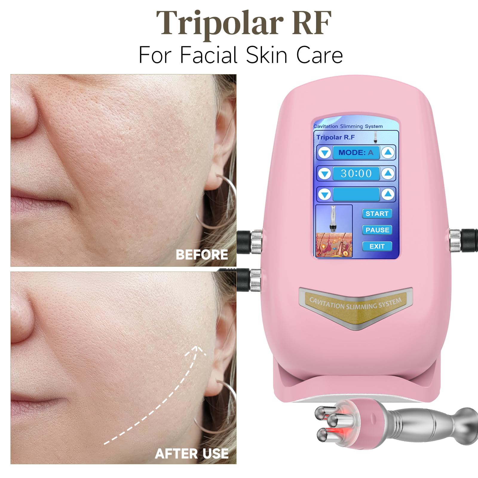 Durskfl Radiofrequenza Viso e Corpo 40K Massaggiatore Anticellulite, 3 In 1 Anticellulite Macchinario Cavitazione Vacuum Cellulite massaggiatore Radiofrequenza corpo Rassodanti e Tonificanti (M)