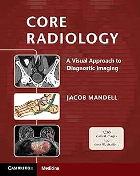 健康・医学 Radiology and Pathology Correlation Radiology and Pathology Correlation of Bone Tumors: A Quick