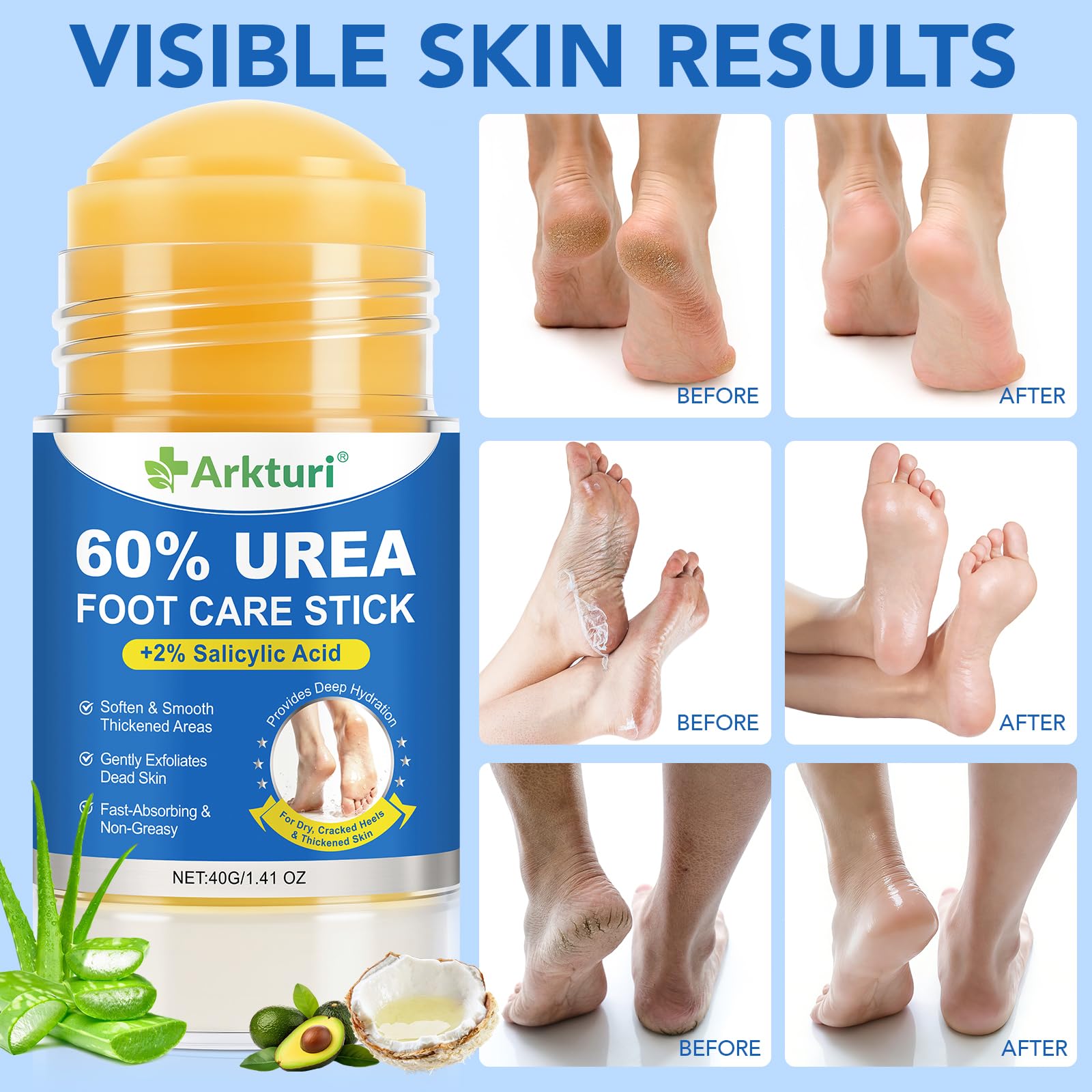 Crema Piedi Urea con 60%, Crema Urea Piedi 40g, Crema Piedi Secchi Screpolati,Rimuove Calli e Talloni Screpolati,Trattamento Idratante Intensivo per Piedi Secchi,Ripara, Ammorbidisce e Leviga la Pelle