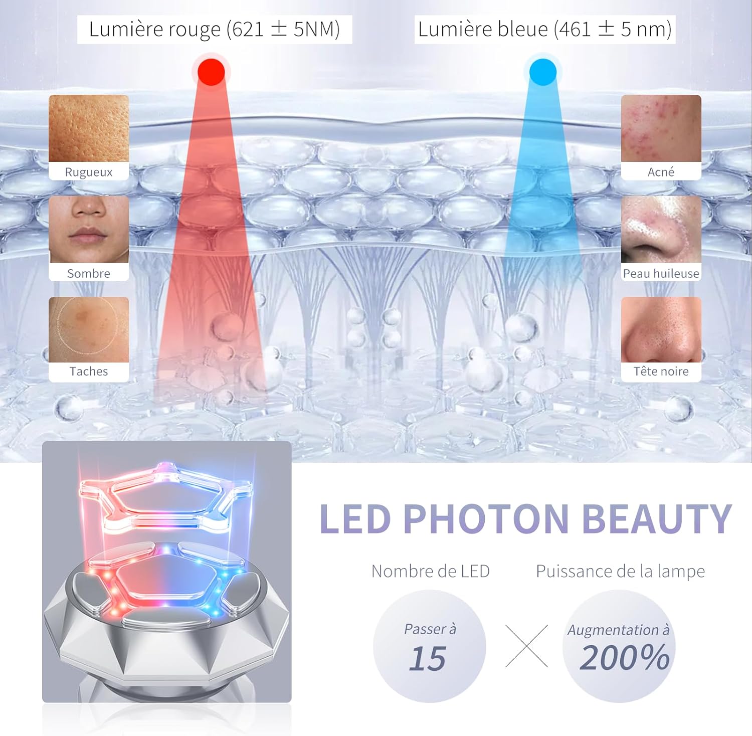 radiofrecuencia indiba