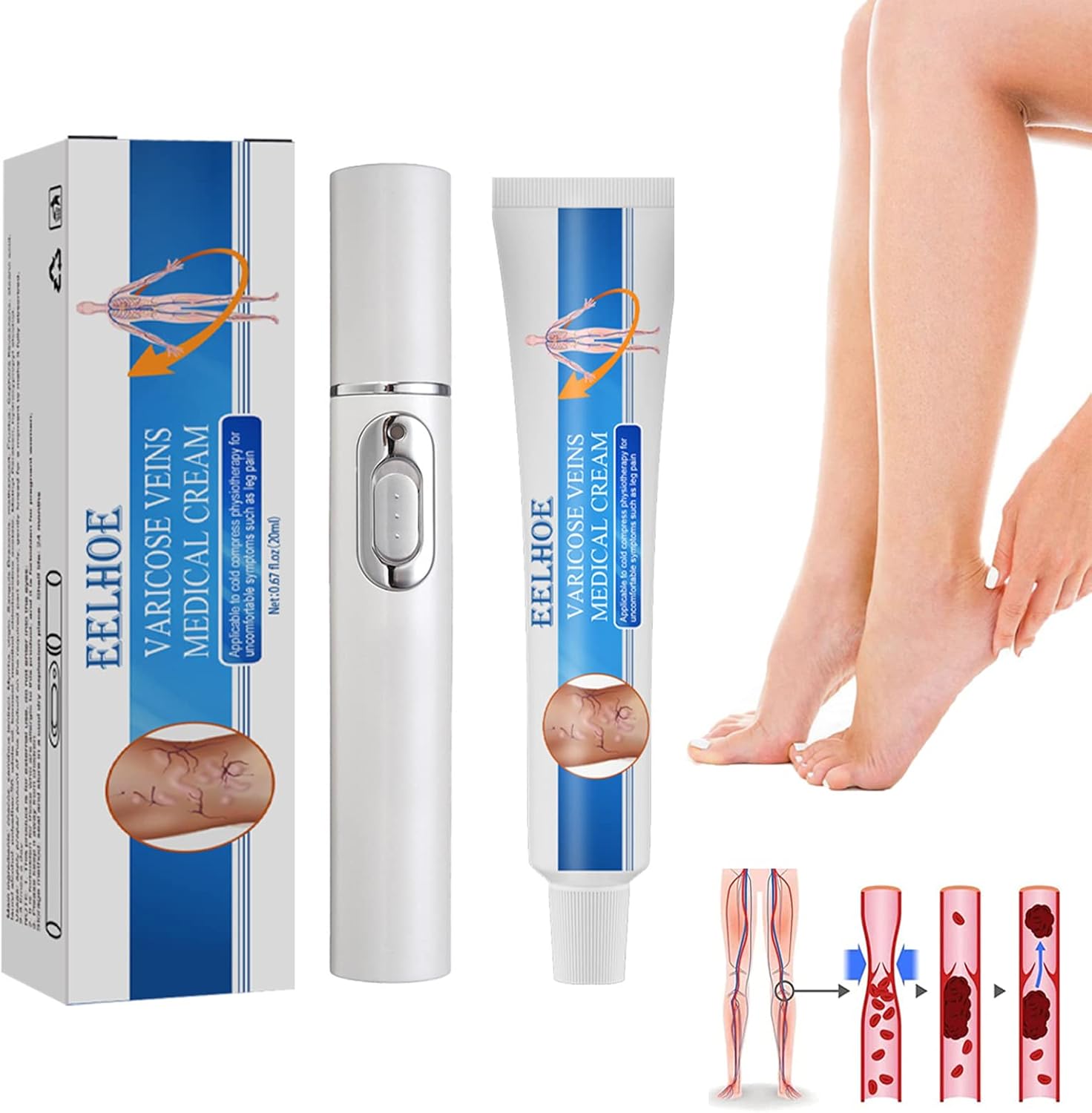 Venoheal Varicose Treatment Cream, veinshealth varicose