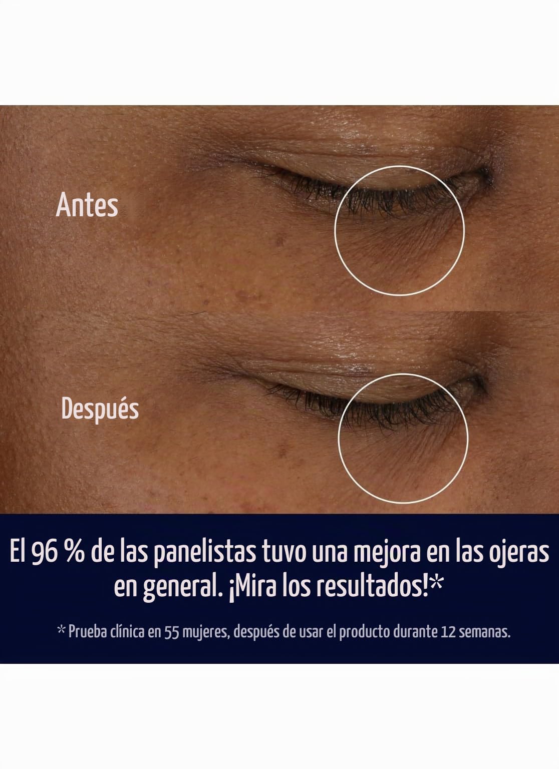 Estée Lauder Crema en gel sobrealimentada para ojos ANR, 15 ml