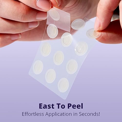 Miniatura 2 de Parches de espinillas para la cara (96 unidades). Parche invisible para acné hidrocoloide para manchas, zits y brotes. Cubierta fácil de usar para