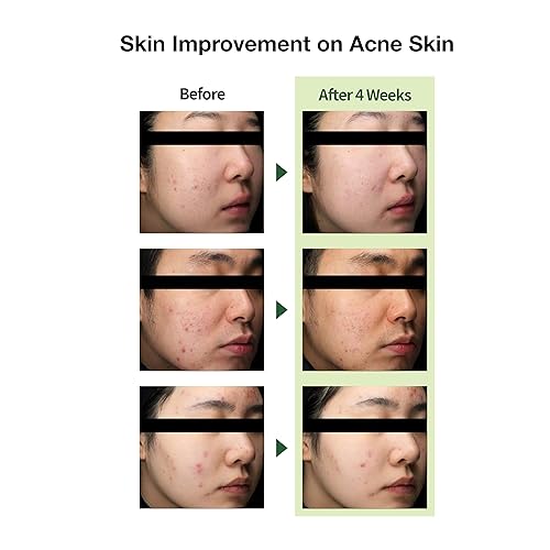 Miniatura 6 de Ligero Cuidado de problemas Hidratante diario Crema calmante acuosa Centella Asiática CICA flavonoide verde - 1.7 Oz Sin aceite sin obstrucción Piel