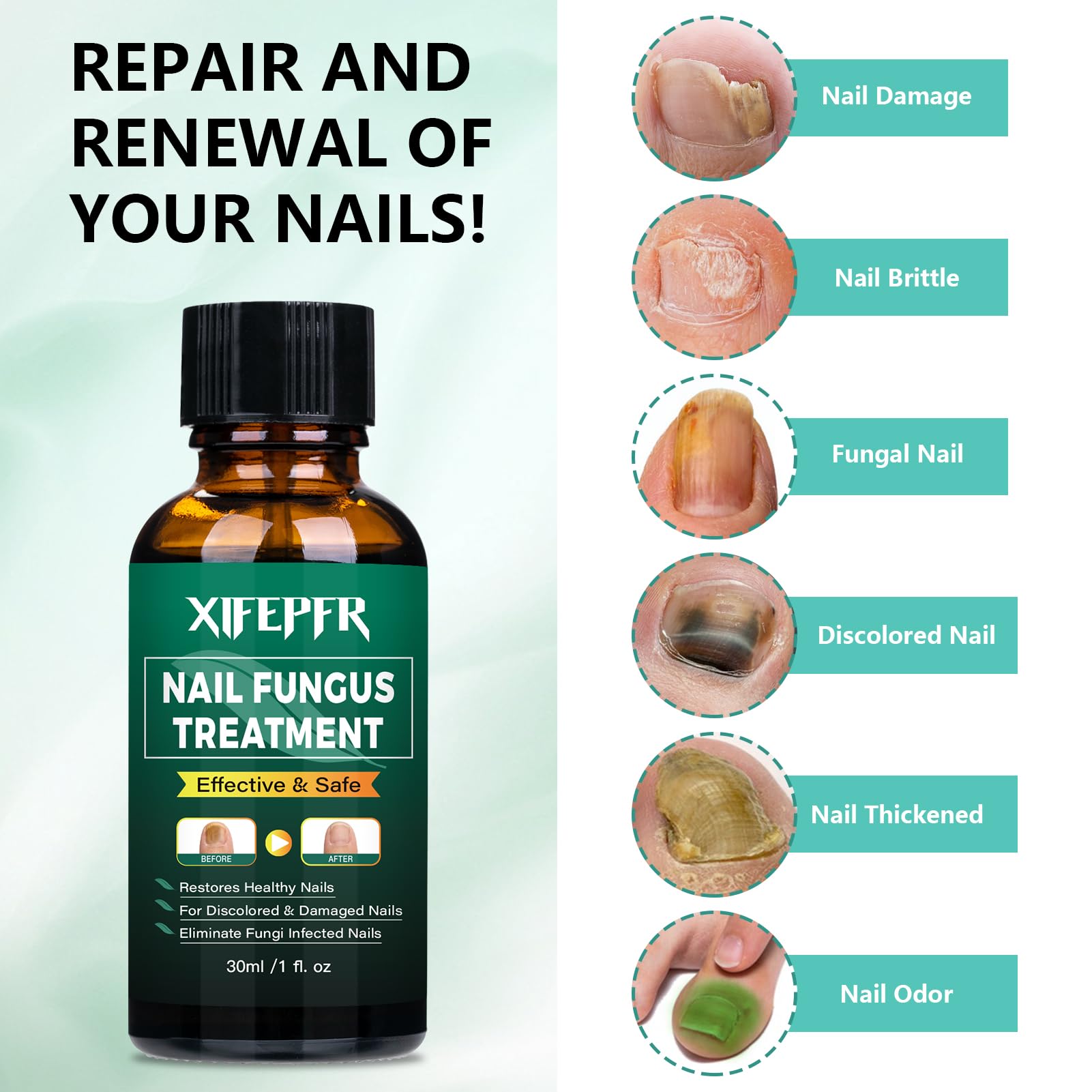 Super strong nail fungus treatment, best nail repair, prevent fungal