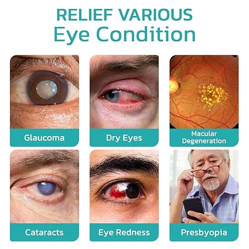 Miniatura 5 de OphthlaMed Vision Enhance Roller, Ophthalmoid Vision Enhance Roller, Vision Enhance Roller, mejora la claridad visual, alivia la fatiga ocular, 0.3