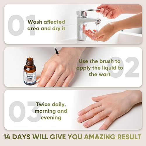 Miniatura 6 de "STAY STOKED" Removedor de verrugas, removedor de verrugas de máxima resistencia, tratamiento resistente para verrugas plantares rebeldes, callos y