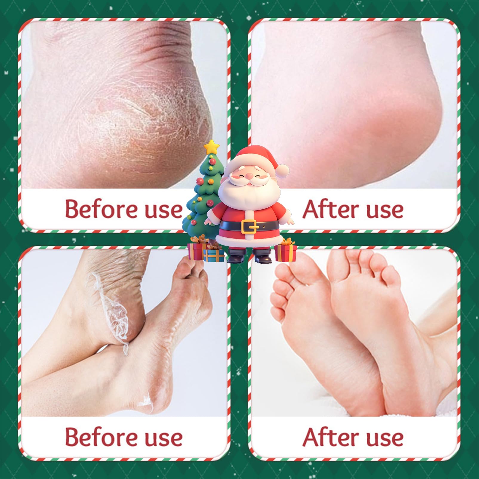 Handmaske & Fußmaske Weihnachten Set, Pflege Peeling Handmasken & Fussmaske Socken, Feuchtigkeitsspendend & Hornhautentfernung, Anti Hornhaut Handpflege Fußpflege für Weihnachts geschenk
