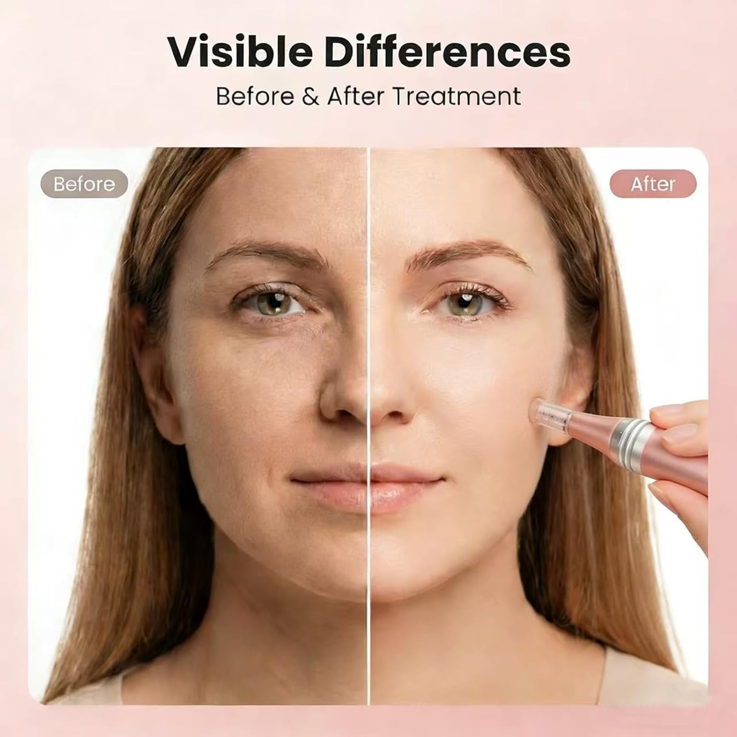 Microneedling Pen 0.25mm Professional Cordless Derma Roller Kit Facial Stamp System for Men Women Home Use Skin Kit Tool