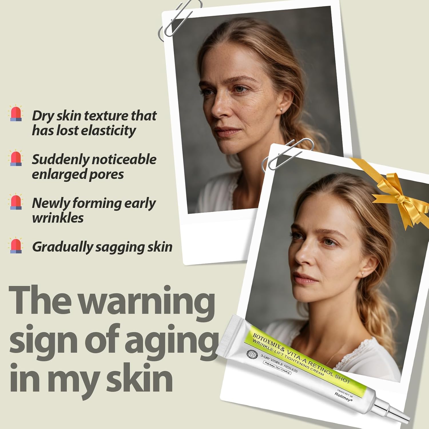 Botoxmix & Vita-A Retinol Shot Wrinkle-Lift Tightening Cream, Vita A Retinal Shot Tightening Booster, Anti Wrinkle cream - Pore Minimizer, Wrinkles & Fine Lines for All Skin-W1 - Image 6