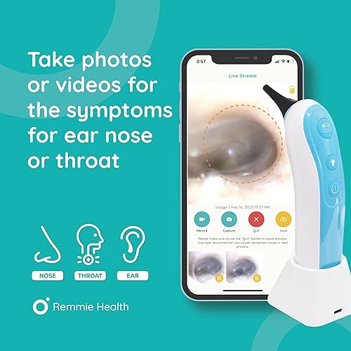 Miniatura 3 de Remmie Dolphin - Otoscopio inalámbrico para oído, otoscopio inalámbrico registrado por la FDA con iPhone, Android y cámara para otorrinolaringología
