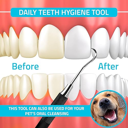 Miniatura 4 de Herramienta profesional raspadora de sarro dental, púa dental, removedor de sarro de doble extremo para dientes, removedor de placa, raspador de