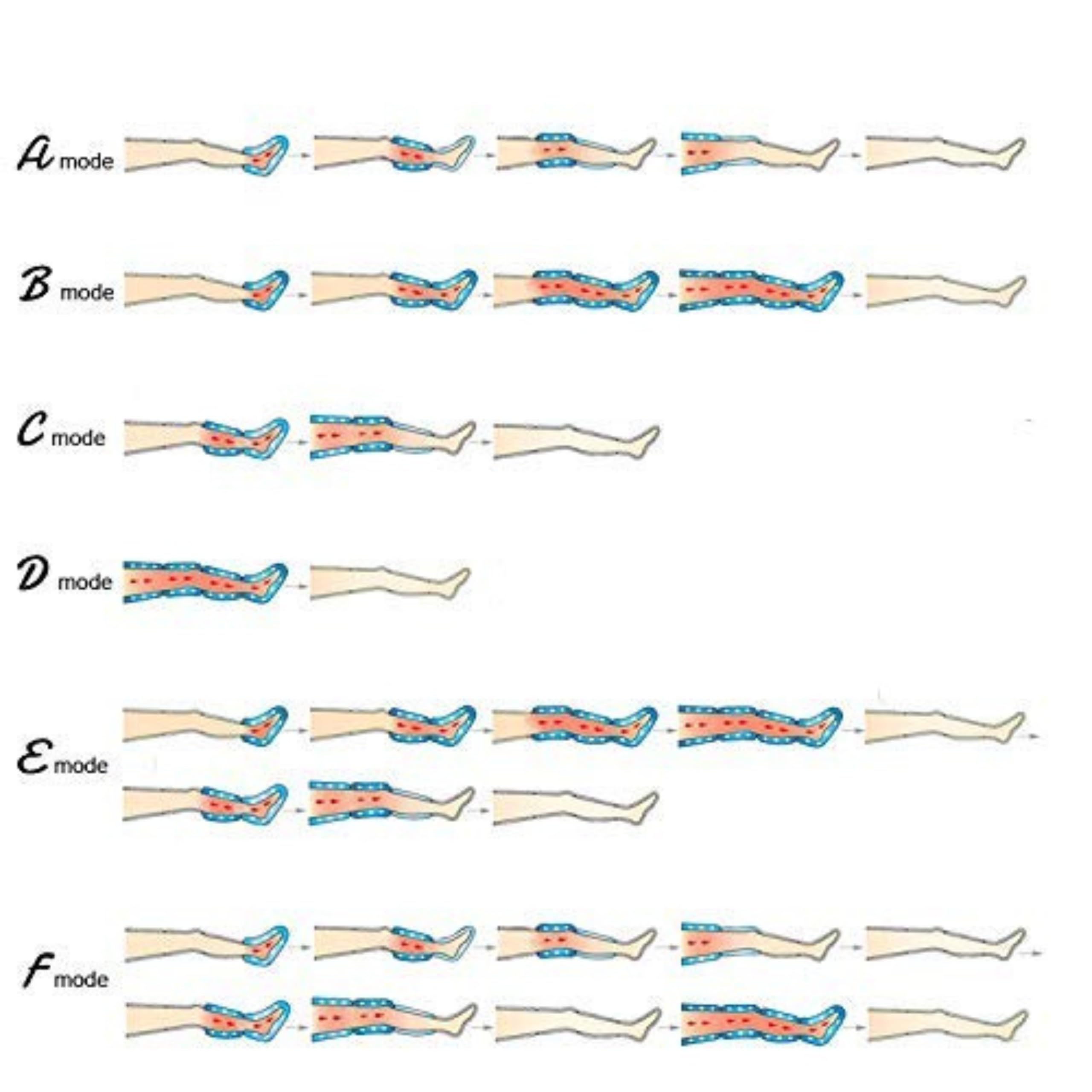 Bottes de pressothérapie jambes FITEM – Jambe lourde & drainage lymphatique | Amélioration Circulation sanguine jambe, massage fluide, confort toutes morphologies, utilisation simple, SAV français
