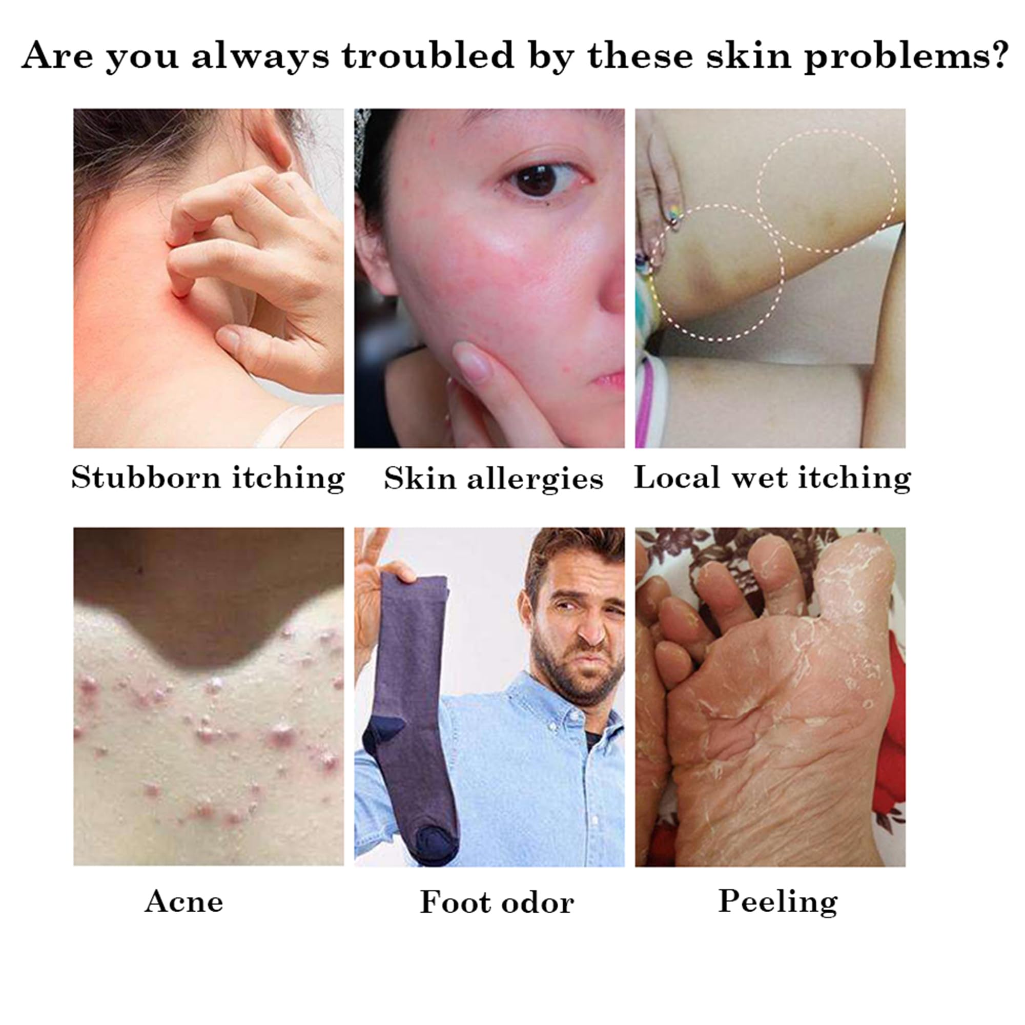 5Pcs Chinese Herbal Eczema Psoriasis Creams Dermatitis and Eczema Pruritus Psoriasis Ointment — Amazon image 5