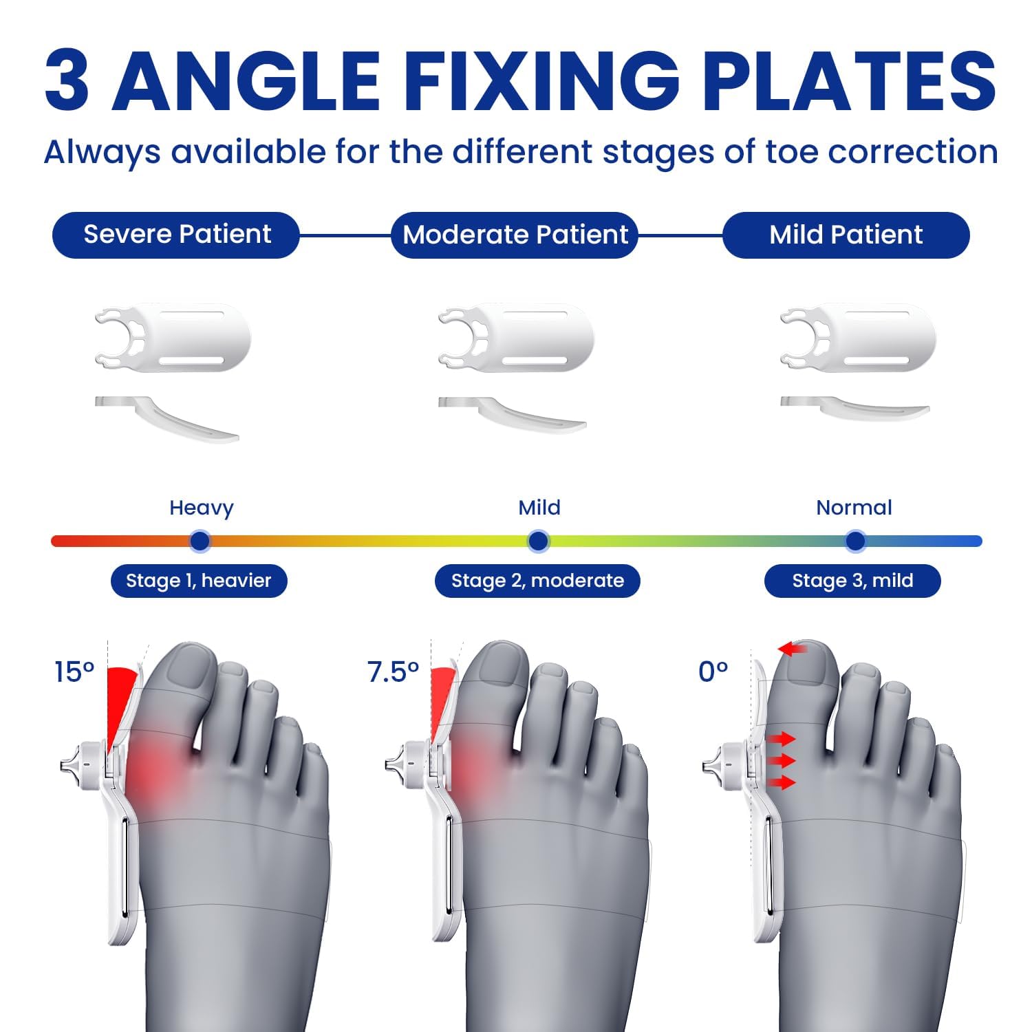 Großzehenglätter mit 4 verschiedenen Winkel Befestigungsplatten, orthopädische Ballenzeh Schiene für Hallux Valgus für Frauen und Männer, Union Corrector